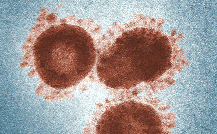 Infectious bronchitis virus